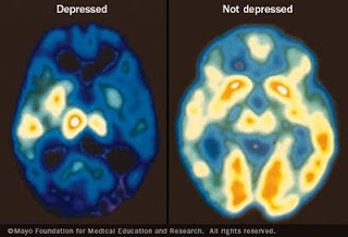 antidepressivi
